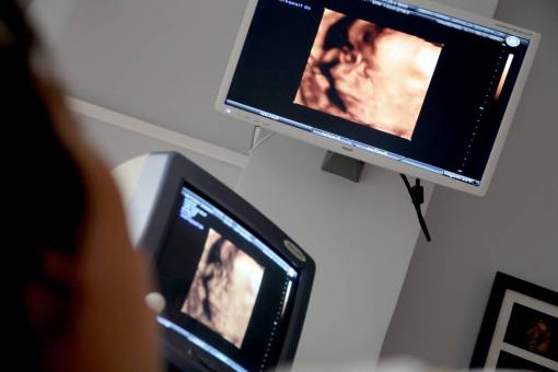 computadora Monitor de ordenador tecnología interior equipo de trabajo informático médico;embarazada;ultrasonido