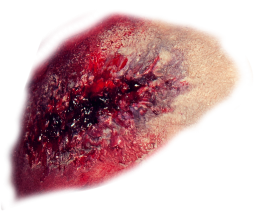 terror Zombie Wound Overlay PNG