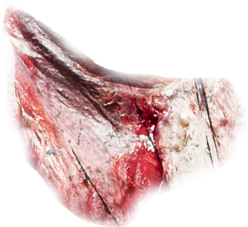 zombie  meat png wound overlay halloween blood zombie