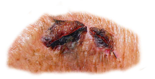 zombie  wound zombie png close-up food halloween overlay