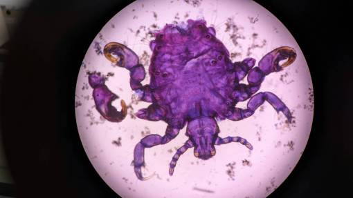 food Parasite in the microscope