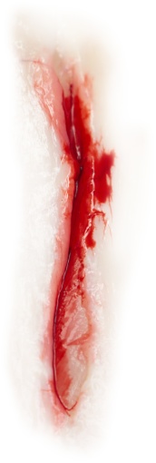 wound  png abstract overlay close-up backgrounds wound blood