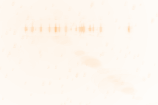 beam  SunFlare Effect Overlay PNG