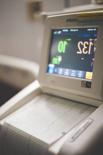 computadora electrocardiograma ciencia tecnología equipo salud y medicina hospital primer plano
