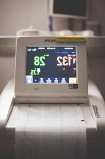 computadora equipo de hospital electrocardiograma computadora monitor de computadora tecnología salud y medicina