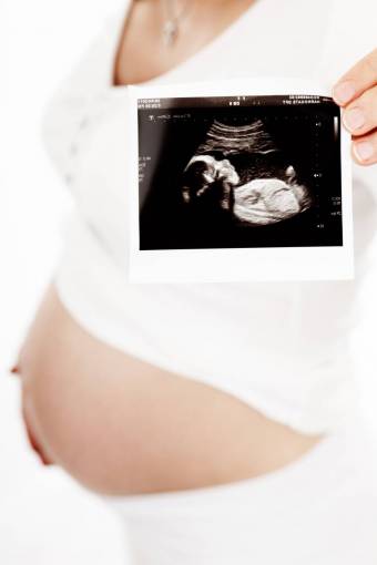 pregnant;woman;ecography women mother human abdomen abdomen new life pregnant