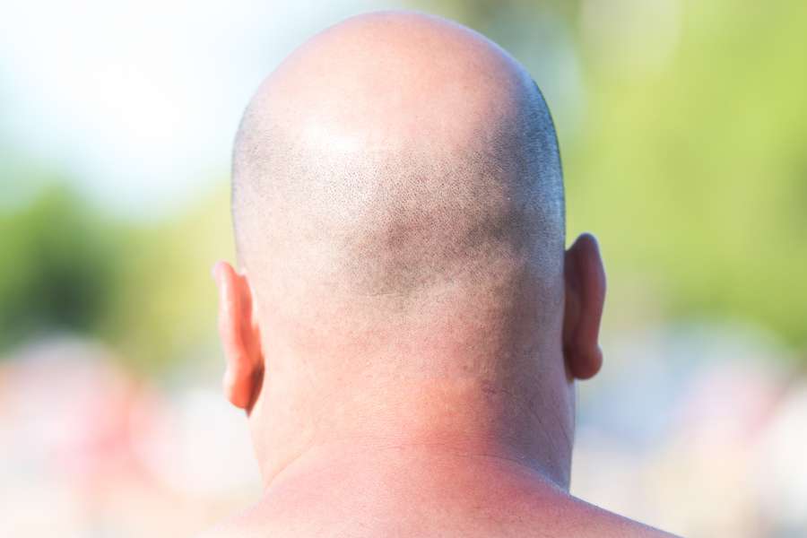 bold, back, adult, men, head, summer, outdoors, day, one person, 