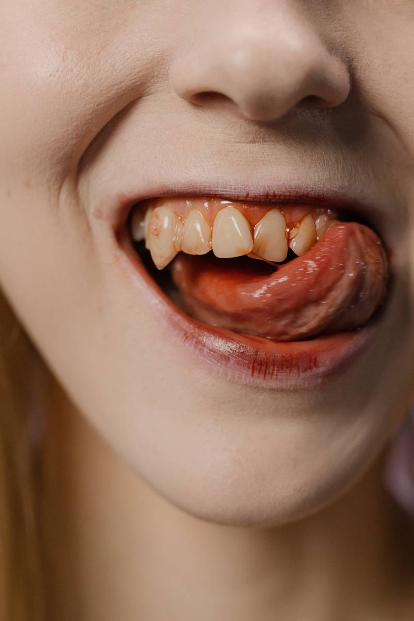 vampire;woman,close-up,human teeth,women,one person,mouth,human mouth,caucasian ethnicity,beauty,adult,human face,smiling,young adult,teeth,human lips,portrait,females,studio shot,happiness,cheerful,one,woman,macro,freshness, 