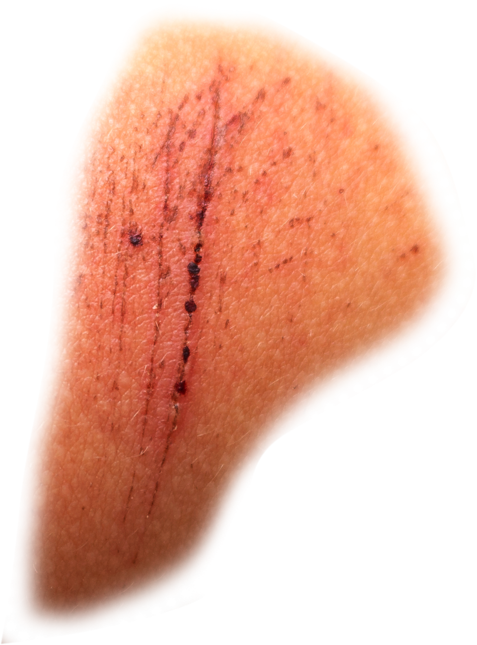  scar,halloween,overlay,png,close-up,nature,healthcare and medicine,medicine,macro,leaf