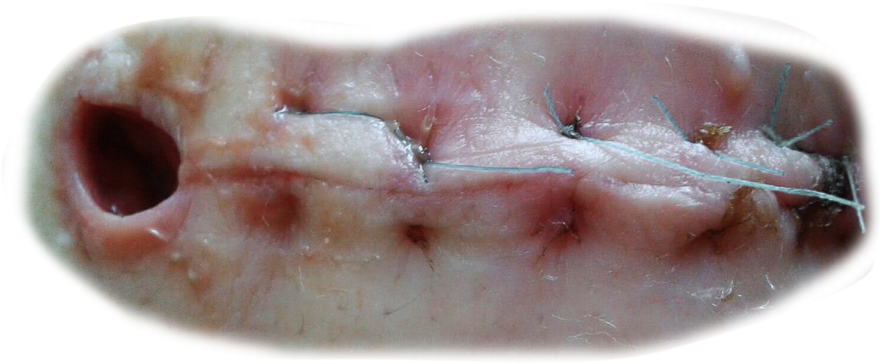  scar,halloween,overlay,png,close-up,healthcare and medicine,pain,medicine,caucasian ethnicity,one person,patient