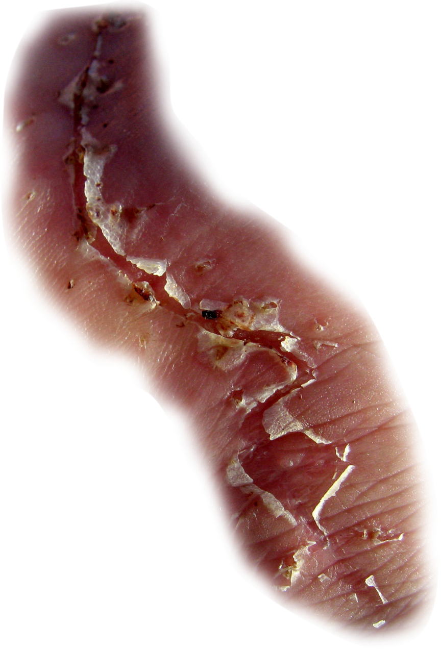  scar,halloween,overlay,png,close-up,nature,macro,backgrounds