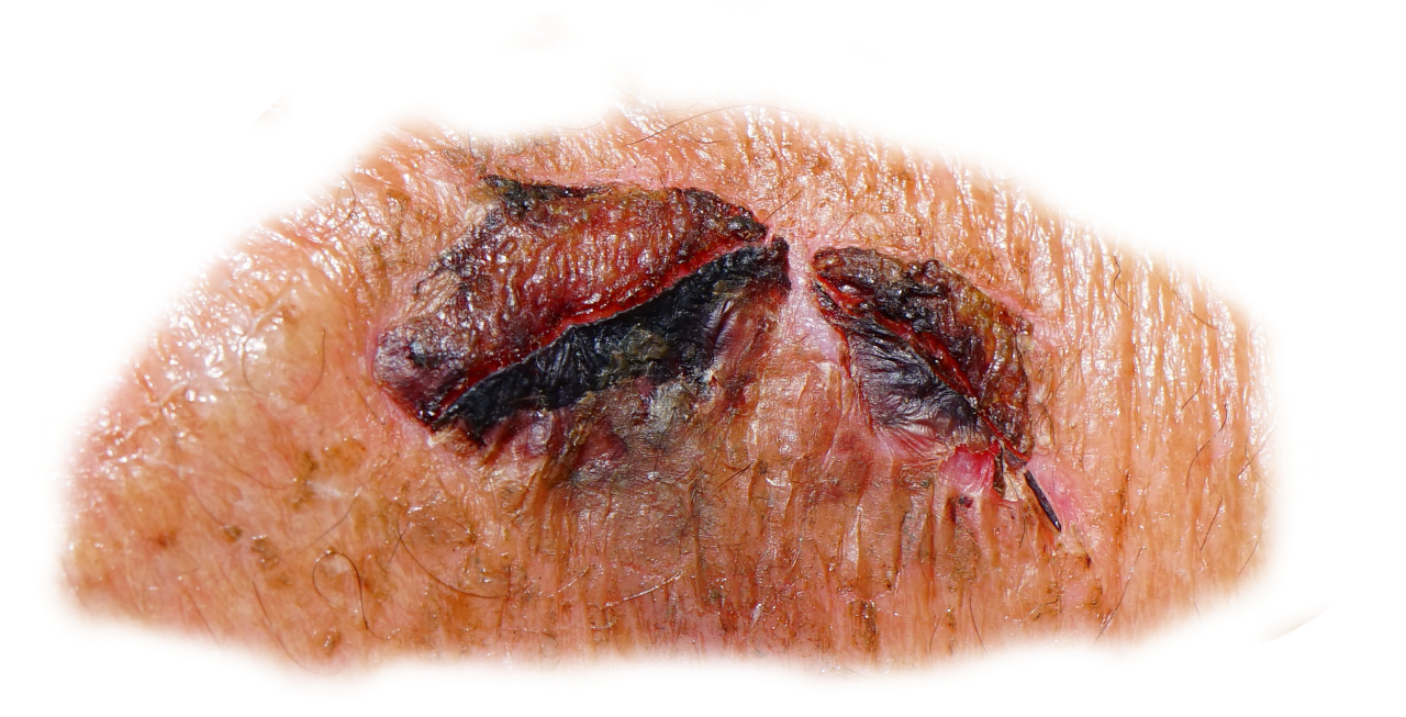  zombie,wound,halloween,overlay,png,close-up,food,animal,meat,backgrounds,blood,macro,pork